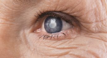 January Glaucoma Awareness Month